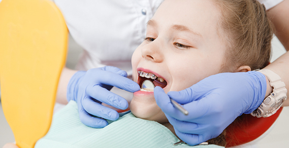 Is Early Dental Care Helpful to Prevent Braces for Kids?