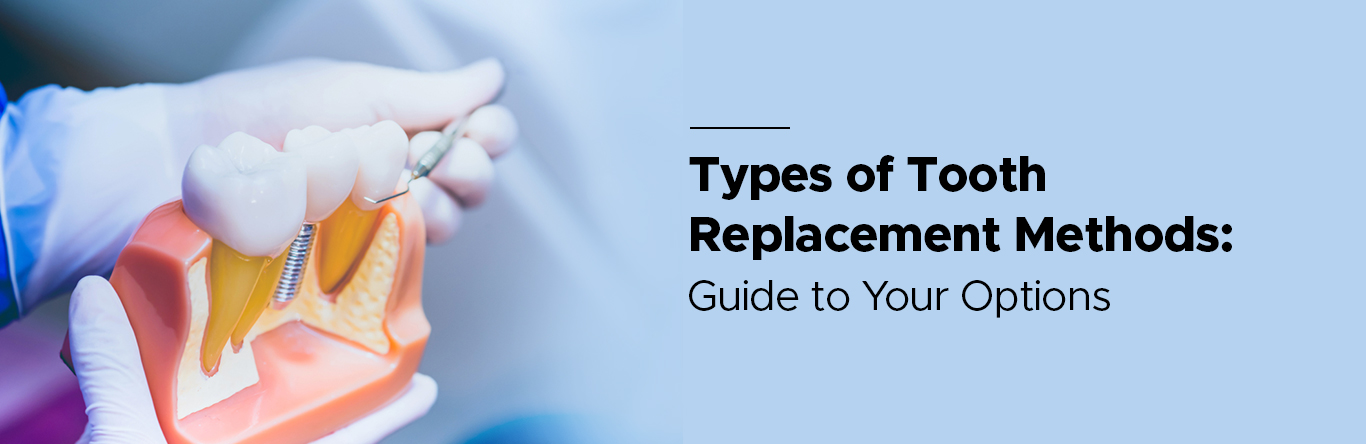 types of tooth replacement methods
