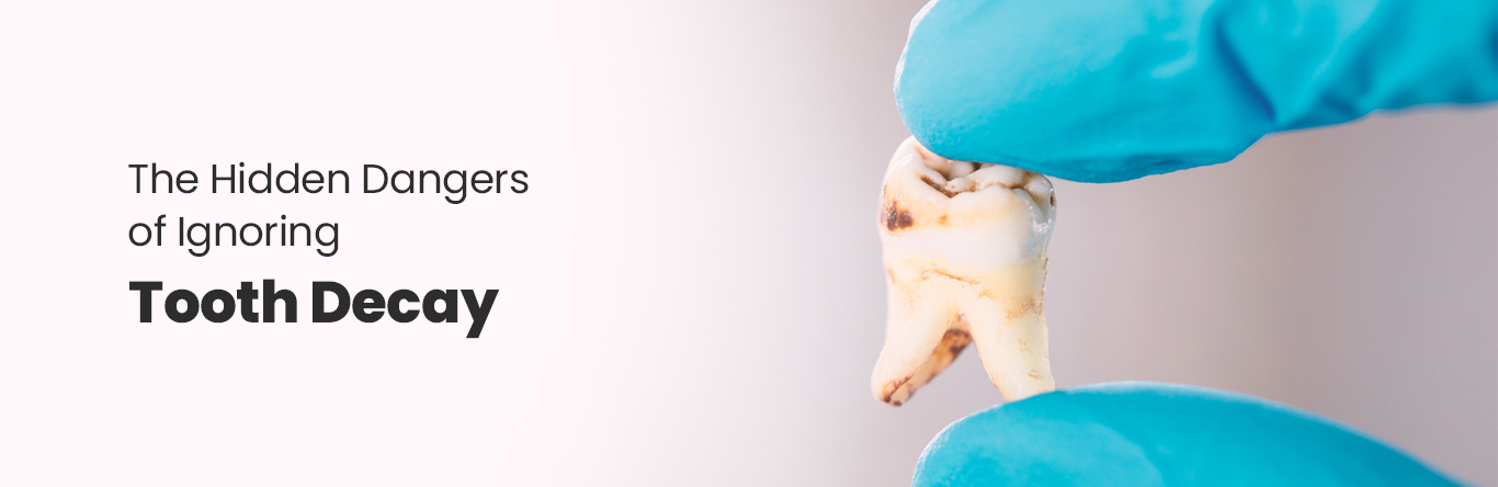 hidden dangers of ignoring tooth decay risks and solutions