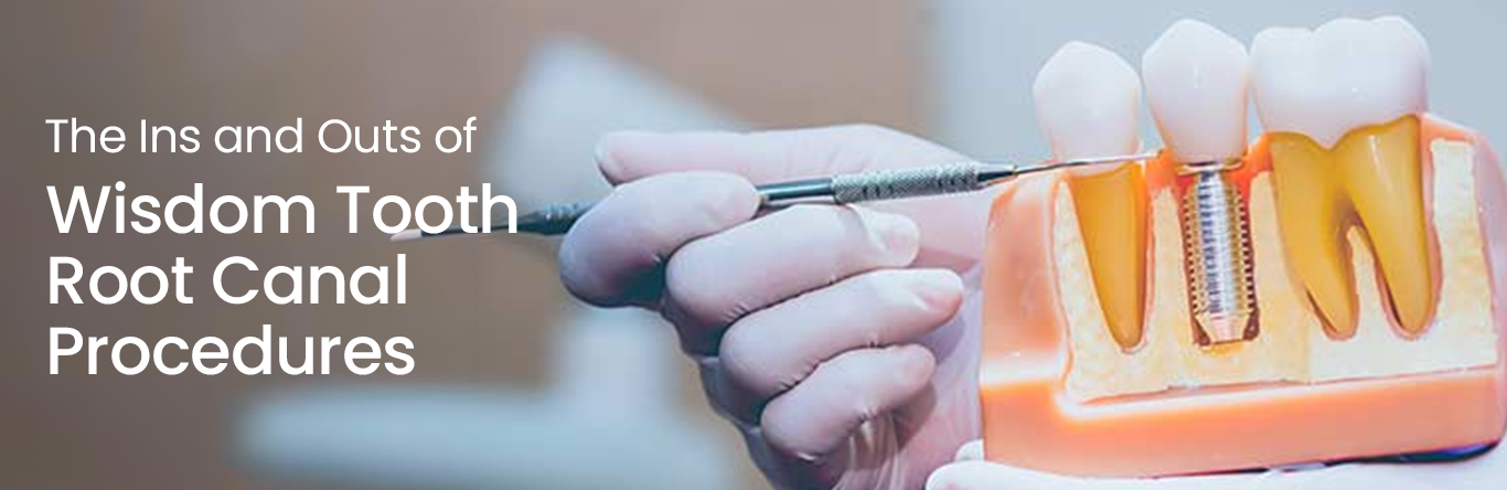 the ins and outs of wisdom tooth root canal