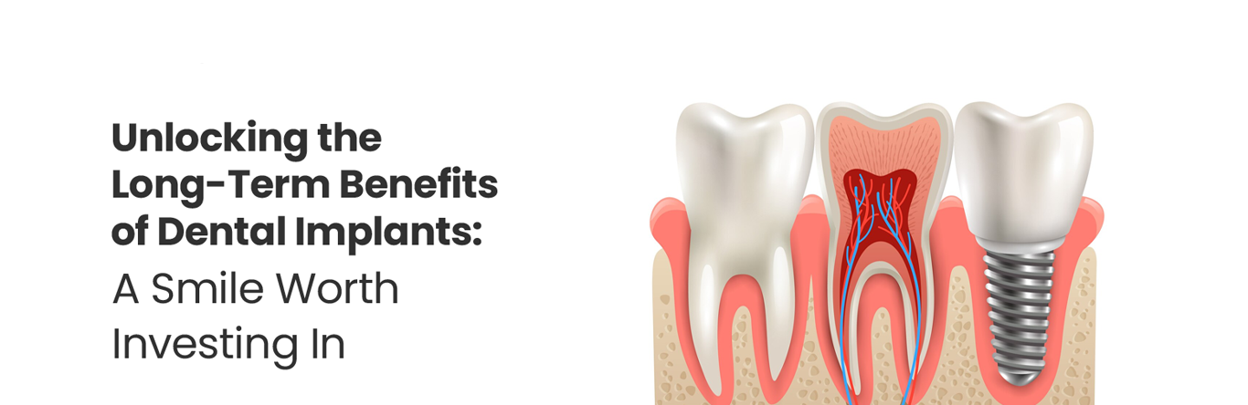 unlocking the long term benefits of dental implants