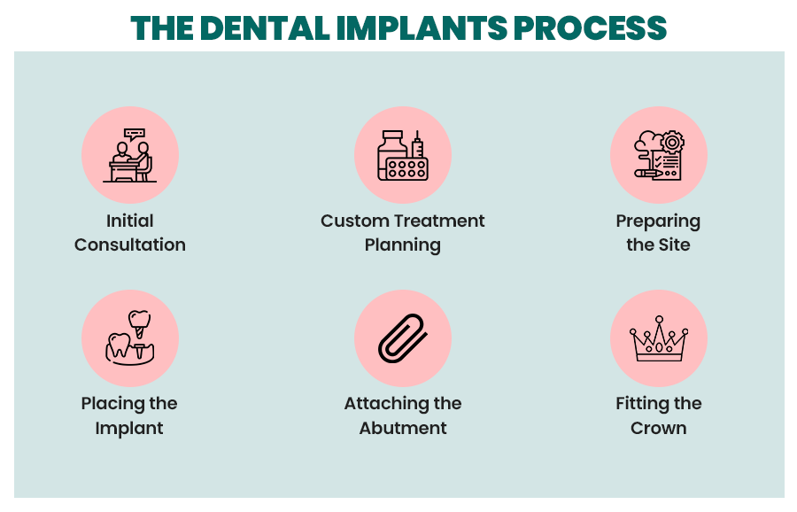 dental implants process
