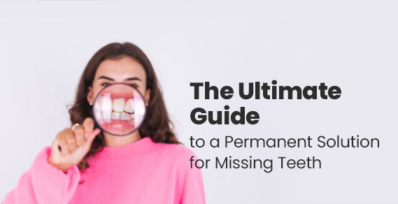 The Ultimate Guide to a Permanent Solution for Missing Teeth