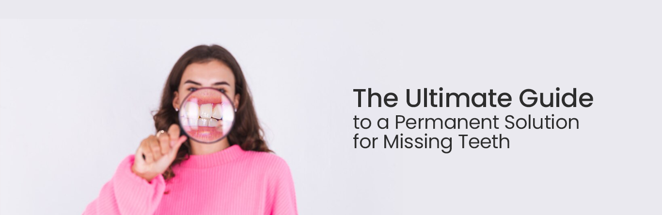 ultimate guide to a permanent solution for missing teeth