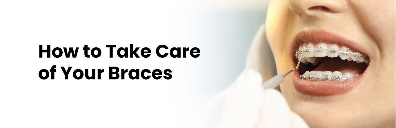 how to take care of your braces
